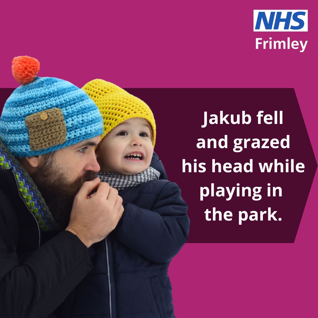 Minor injury unit social media image - head injury 1